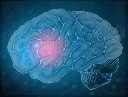 Doctors Fail to Reverse Anticoagulant in Hemorrhagic Stroke Patient