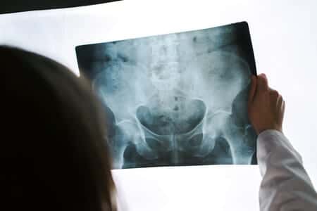 Woman Alleges Stryker Hip Product Caused Nerve Damage