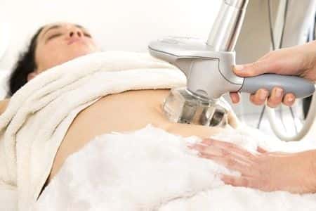 SmartLipo Procedure Leaves Woman Severely Scarred