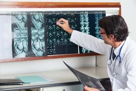 Renowned Radiology Expert Opines on Doctors’ Failure to Identify Wood Fragments in Patient’s Leg