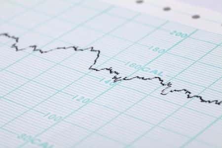 Newborn Suffers Traumatic Brain Injury During Complicated Delivery