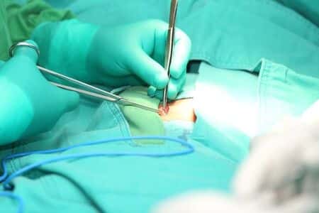 Surgical Implant Causes Allergic Reaction