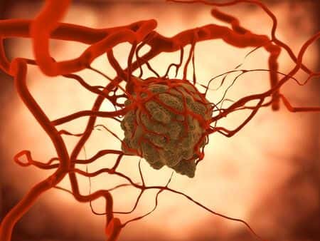 Hospital Fails to Inform Patient of Cancer Diagnosis