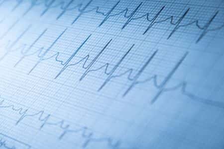 Patient Dies From Massive Heart Attack After Leaving ER